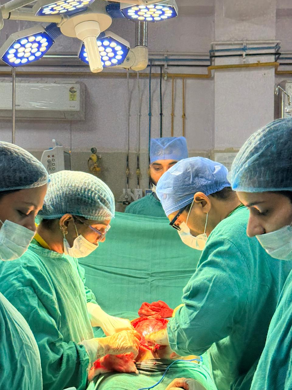 Dr. Gyanendra Mittal, Surgical Oncologist and Team performing a meticulously planned high-risk surgery to remove a 22 cm uterine sarcoma.